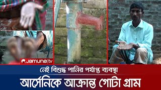 এক বিষে আক্রান্ত গোটা গ্রামের মানুষ; বিষের নাম আর্সেনিক | Arsenic Village | Jamuna TV