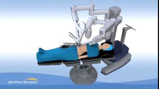 Single Site Robotic Gallbladder Surgery