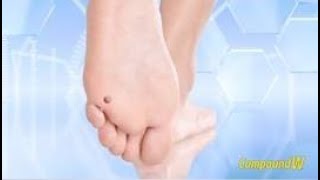 Remove Plantar Warts Fast with Compound W®