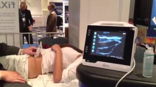 Ultrasound Guided Illeoingunal Nerve Block