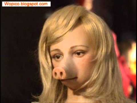 Sad Story About A Girl With Piggy Nose *MUST SEE* - YouTube