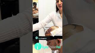 Kevin Benedico Washing Hair after Hair Transplant in Ilyas Arslan Hair #hairtransformation #haircare