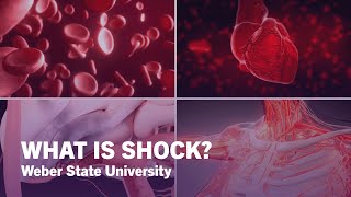 What Is Shock: Types of Shock \u0026 How It Affects the Body - Weber State University