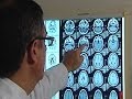 Brain injury linked to suicide, car accident risk