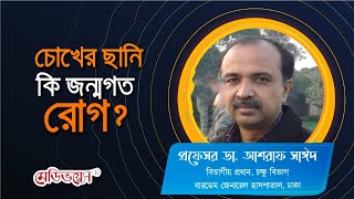 চোখের ছানি কি জন্মগত রোগ? | অধ্যাপক ডা. আশরাফ সাঈদ | Medivoice