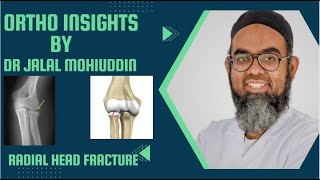 RADIAL HEAD FRACTURE BY DR JALAL MOHIUDDIN