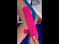 kinesiotaping para lesión de ligamentos colaterales de la rodilla.