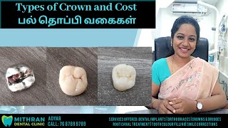 Types of Crown and Cost | பல் தொப்பி வகைகள் | MithranDental Chennai Adyar