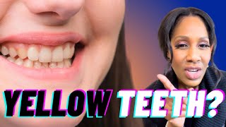 How to GET WHITE TEETH \u0026 Common Causes Teeth Discoloration!  Doctor Explains