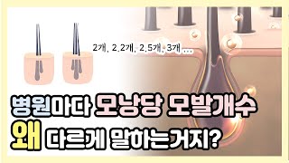 모낭당 모발개수 병원마다 다른이유? #2개 #2.3개 #3개