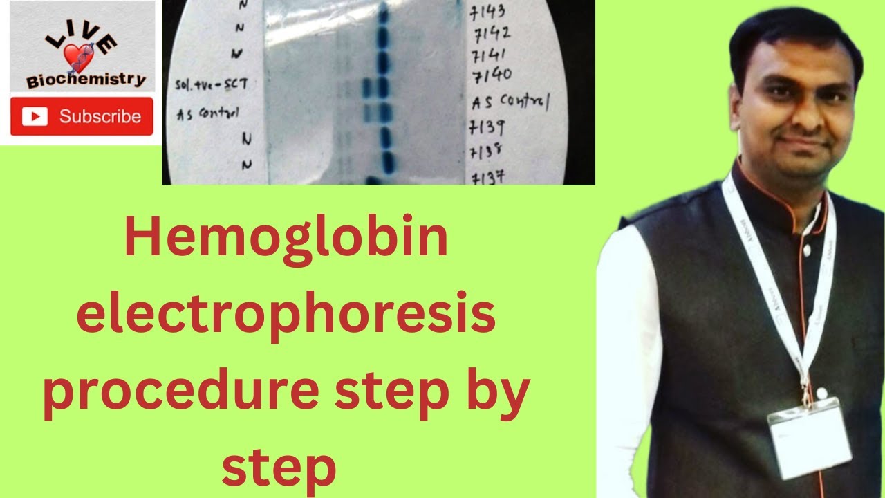 Hemoglobin Electrophoresis Procedure | Agarose Gel Hemoglobin ...