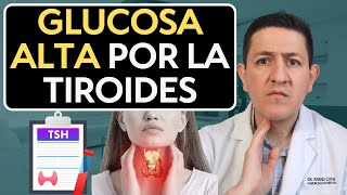 High glucose due to thyroid Dr. Antonio Cota Sugar Care