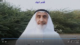 قضم الجلد