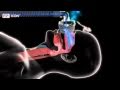 Fisher and Paykel ICON Series CPAP Machine - In Use Animation Fisher and Paykel ICON Series CPAP Machine - In Use Animation