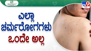 Shathayu ayurveda Episode No.97: Treatment for Skin Disease: ಎಲ್ಲಾ ಚರ್ಮರೋಗಗಳು ಒಂದೇ ಅಲ್ಲ | #tv9d