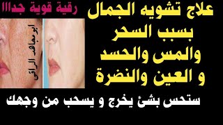 رقيه شرعيه علاج تشويه الجمال وفك عقد الوجه بسبب السحر والحسد والمس استرجع جمالك فورا باذن الله