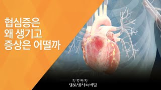 협심증은 왜 생기고 증상은 어떨까 - (20140226_495회 방송)_심장의 적신호! 폐경기 여성을 노린다