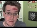 CONCUSSED Question Friday