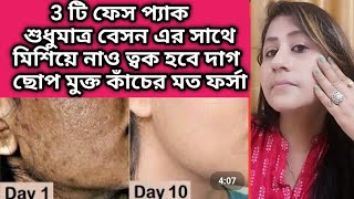 শুধুমাত্র বেসনকে এইভাবে ব্যবহার করো ত্বক কাঁচের মতো ফর্সা হবে/Get rid of Pigmentation/Pigmentation