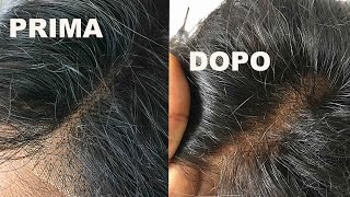 COME DECOLORARE  I NODI DI UNA LACE FRONTAL | Per Principianti | Come avere Una FRONTAL TRASPARENTE