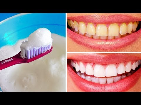 10 Natural Ways to Whiten Teeth at Home 10 Natural Ways to Whiten Teeth at Home