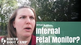 What is an internal fetal monitor?