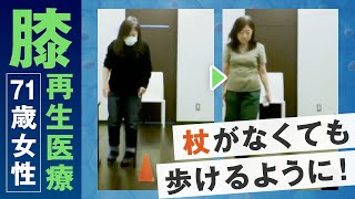 ひざの再生医療により、杖がなくても歩けるようになった歩行症例【培養幹細胞治療】