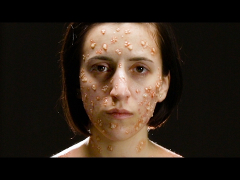 What Deadly Diseases Look Like On Your Body What Deadly Diseases Look Like On Your Body