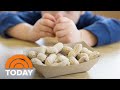 Peanut allergy skin patch shows promise for toddlers