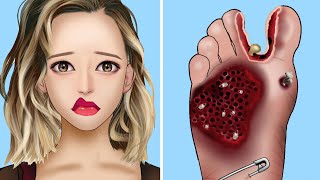 ASMR Remove Worm and Maggot Infected Foot | Severely Injured Animation | Braini ASMR