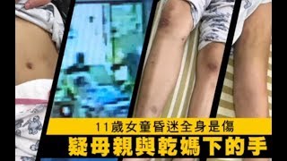 媽只打腳底卻顱內出血昏迷？　鄰居：女童慘叫「頭好痛」 | 台灣蘋果日報