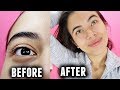 Permenant eye color change surgery... (My journey of wanting it and why I chose not to) Permenant eye color change surgery... (My journey of wanting it and why I chose not to)