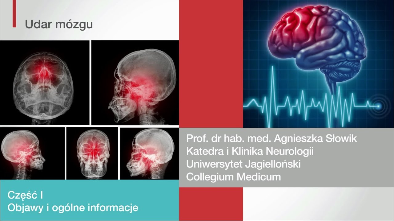 Udar Mózgu, Część 1: Objawy I Ogólne Informacje - YouTube