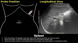 How To Scan The Spleen On Ultrasound | Probe Positioning | Transducer Placement