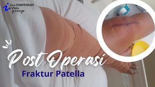 Latihan pasca operasi tempurung lutut || post op fraktur patella