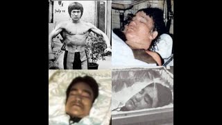 How did Bruce Lee die? His doctors speak!!!