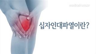 십자인대 파열, 운동선수만 발생한다?