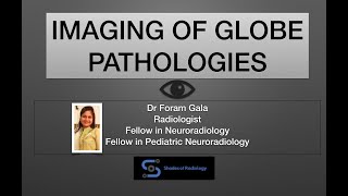 Globe pathologies - Made easy