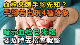 血栓來臨手腳先知？ 提醒：手腳若出現4種跡象，或許血栓已來臨。要及時去就醫檢查。【幸福Talks】#中老年心語 #長壽 #養生 #幸福人生 #為人處世 #深夜讀書 #健康養生 #血栓