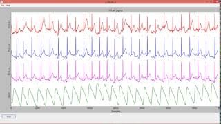 WxPython based Real time Vital Sign monitor GUI Demo