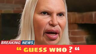 10 Famous Celebrities Unrecognizable After Plastic Surgery Gone Wrong | Then and Now 2026