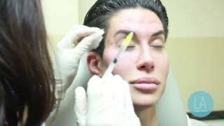 Justin Jedlica gets Botox
