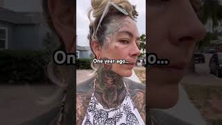 One year of tattoo removal progress