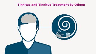 Tinnitus and Tinnitus Treatment by Oticon