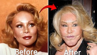 Top 10 Celebrity Plastic Surgery That Shocked the World! – You Won’t Believe #2!