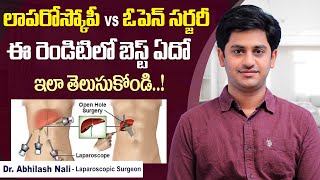 Laparoscopy vs Open Surgery || Difference Between Laparoscopy and Open Surgery || Dr Abhilash Nali