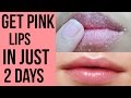 How to get pink lips/ Lighten dark lips naturally at home/ Get Rid Of Chapped Lips