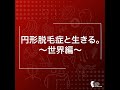 円形脱毛症と生きる〜日本編〜