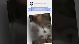 Awake Inverted Nipple Correction procedure