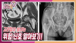 [무엇이든 물어보세요] 고관절이 보내는 위험신호! 고관절 질환의 증상과 원인 알아보기 | KBS 230213 방송